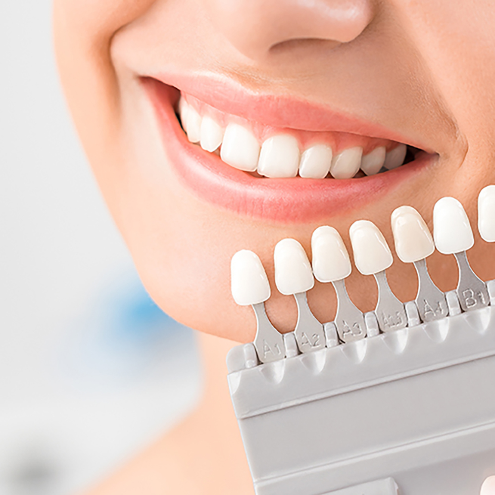 倉敷市のデュアルホワイトニング