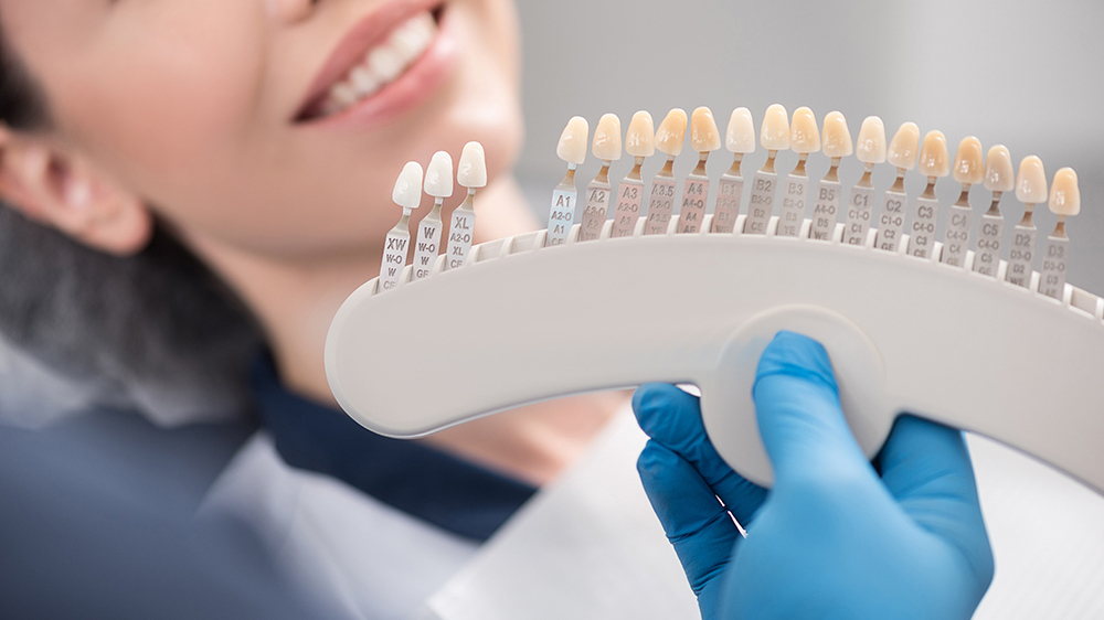 倉敷市のデュアルホワイトニング