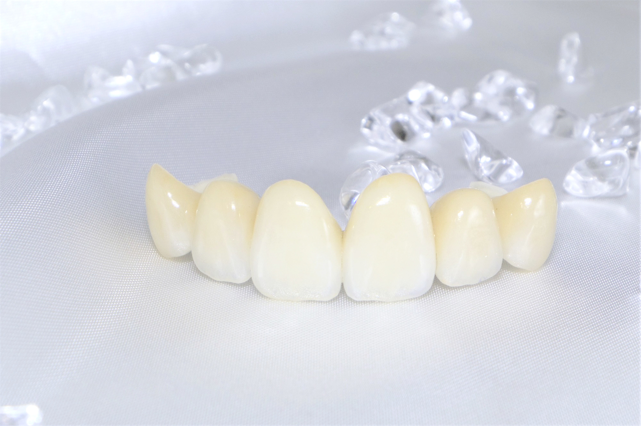 倉敷市のジルコニア治療