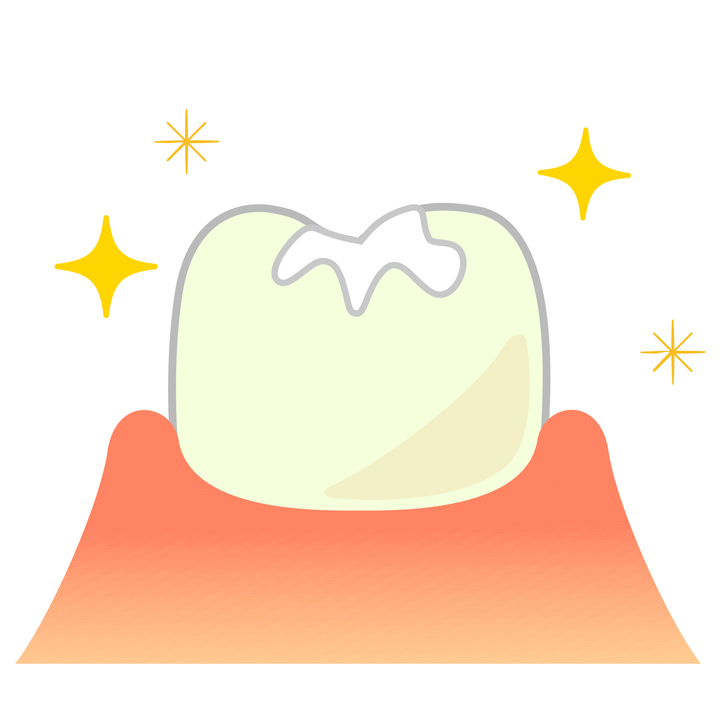 倉敷市の虫歯の治療