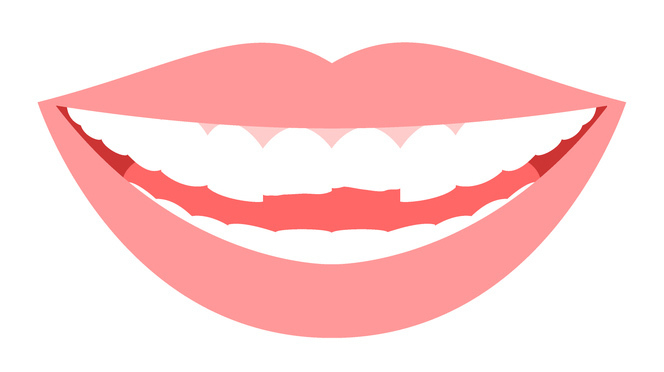 倉敷市の歯ぎしり・食いしばりの治療 （ナイトガード）