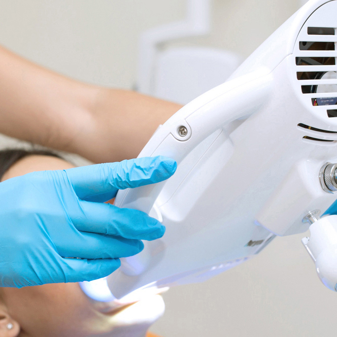 倉敷市のオフィスホワイトニング