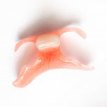 倉敷市の入れ歯の治療