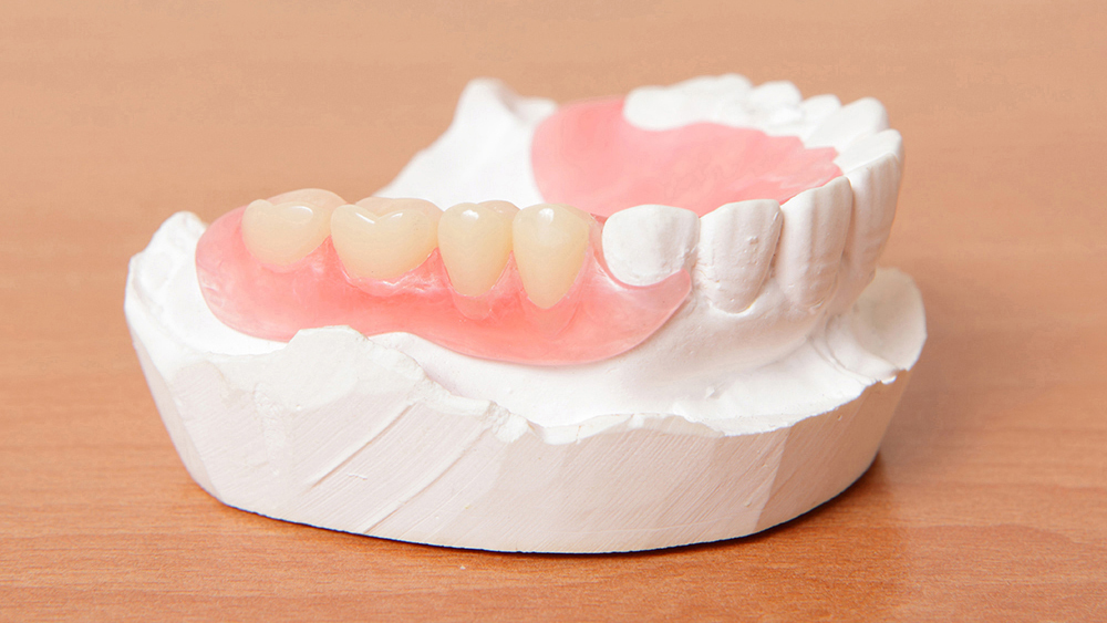 倉敷市の入れ歯の治療