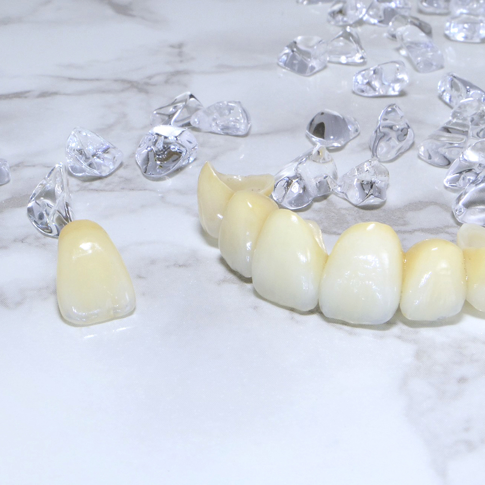 倉敷市のジルコニア治療