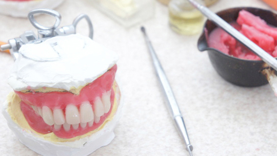 倉敷市の入れ歯の治療