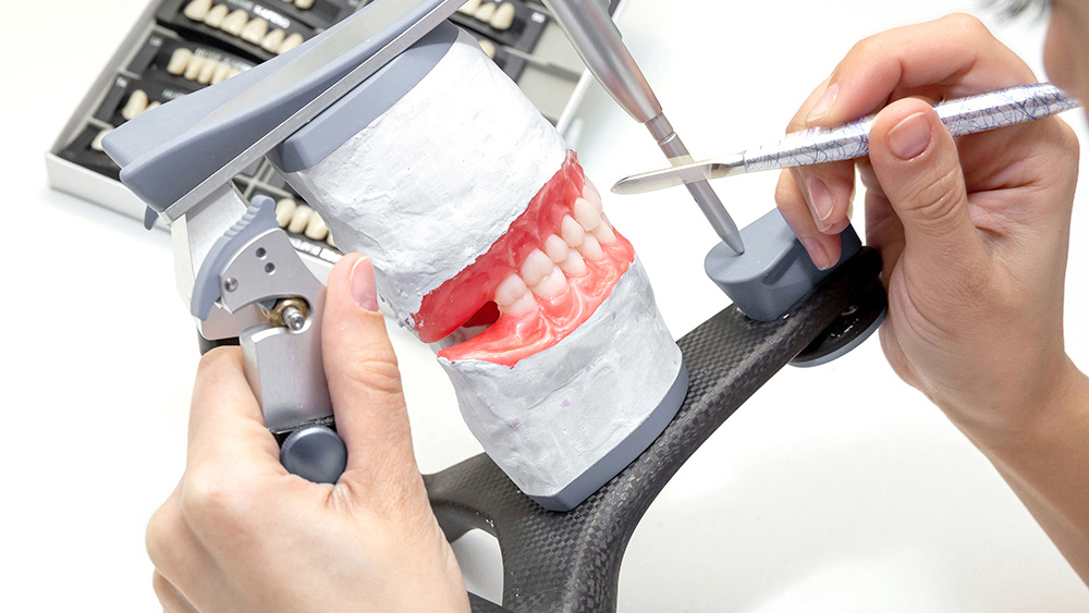 倉敷市の入れ歯の治療