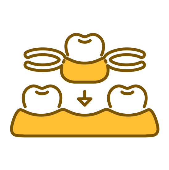 倉敷市の 入れ歯の治療