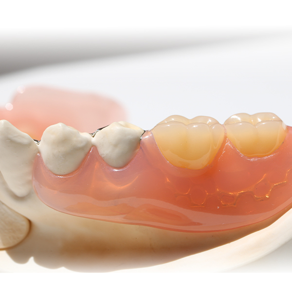 倉敷市の入れ歯の治療