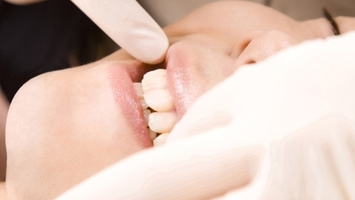 倉敷市の親知らずの抜歯・治療