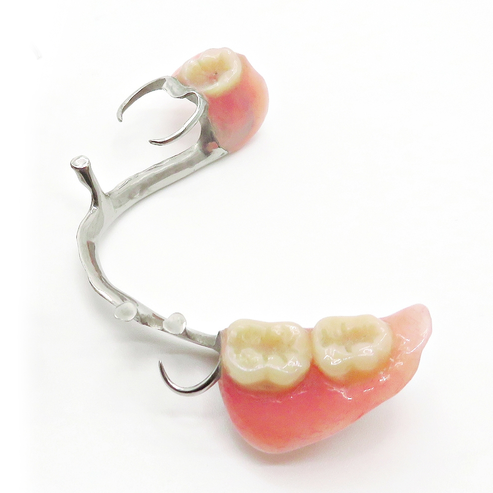 倉敷市の入れ歯の治療