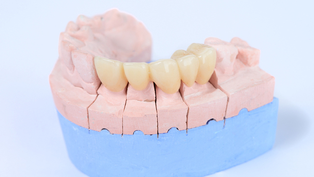 倉敷市のジルコニア治療